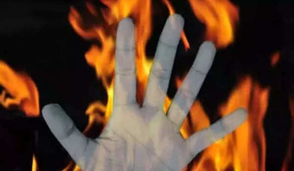 Puri Horror Live News Updates: Minor girl set ablaze by miscreants, airlifted to AIIMS Delhi with 75% burns, in critical condition